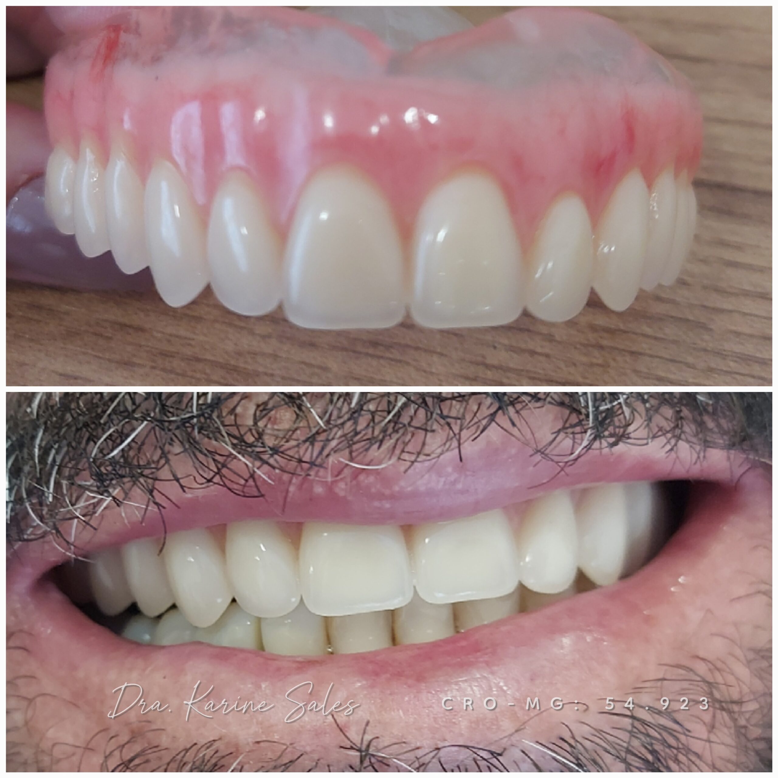 Dentadura 9